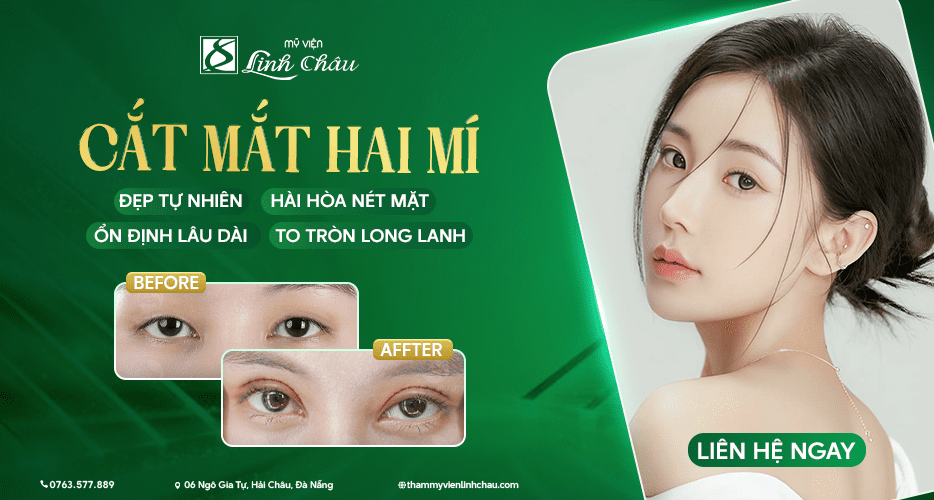 Dịch vụ Cắt mắt hai mí tại Mỹ viện Linh Châu