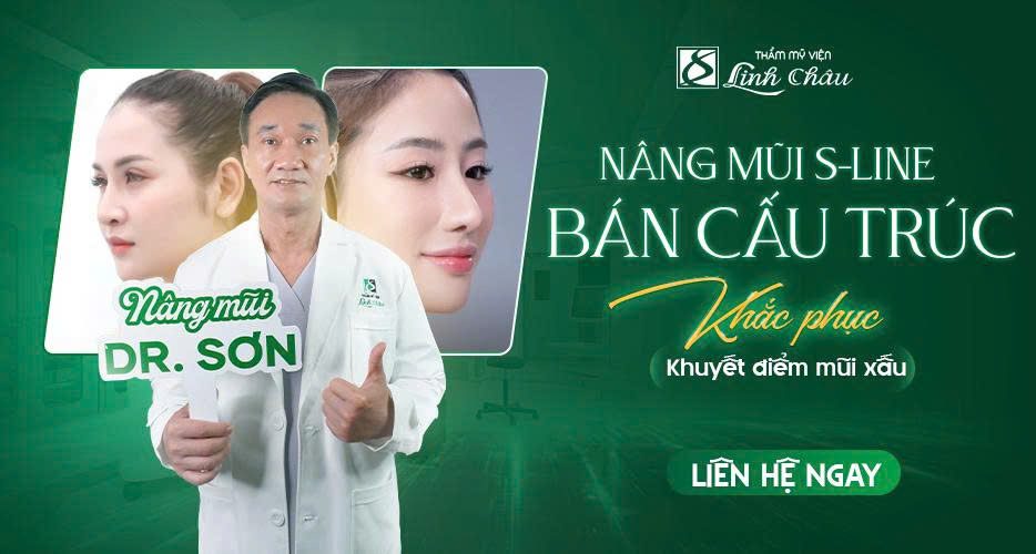 Nâng mũi bán cấu trúc tại TMV Linh Châu Đà Nẵng