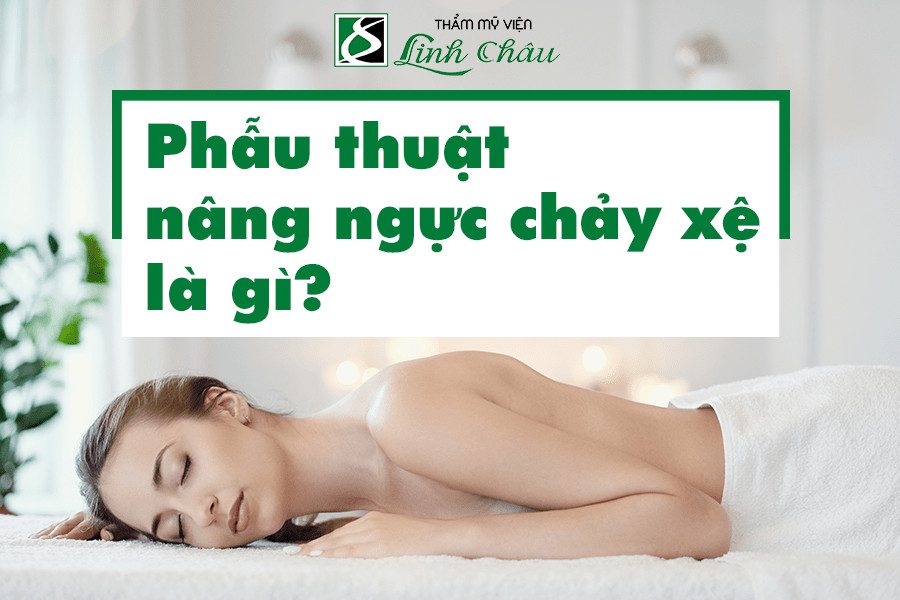 Phẫu thuật nâng ngực chảy xệ là gì