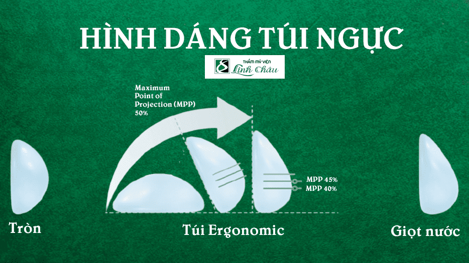 Hình dáng túi ngực 