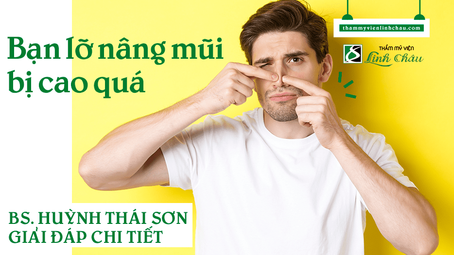 Nâng mũi bị cao quá và cách khắc phục