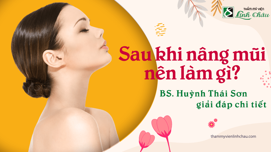 Sau khi nâng mũi nên làm gì