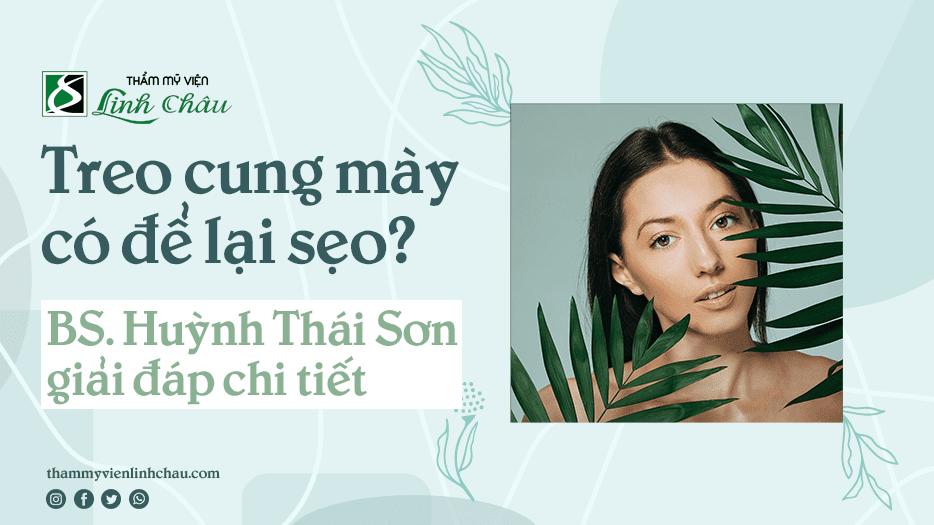 Treo cung mày có để lại sẹo không?