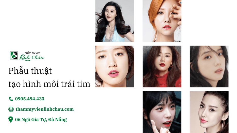 Phẫu Thuật Tạo Hình Môi Trái Tim Đà Nẵng - Thẩm Mỹ Viện Linh Châu