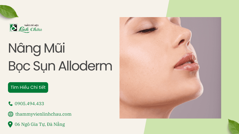 Nâng Mũi Bọc Sụn Alloderm - Tìm Hiểu Chi Tiết Cùng TMV Linh Châu