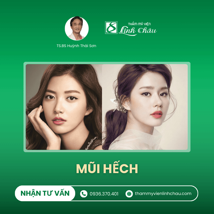 Dáng Mũi Hếch - TMV Linh Châu