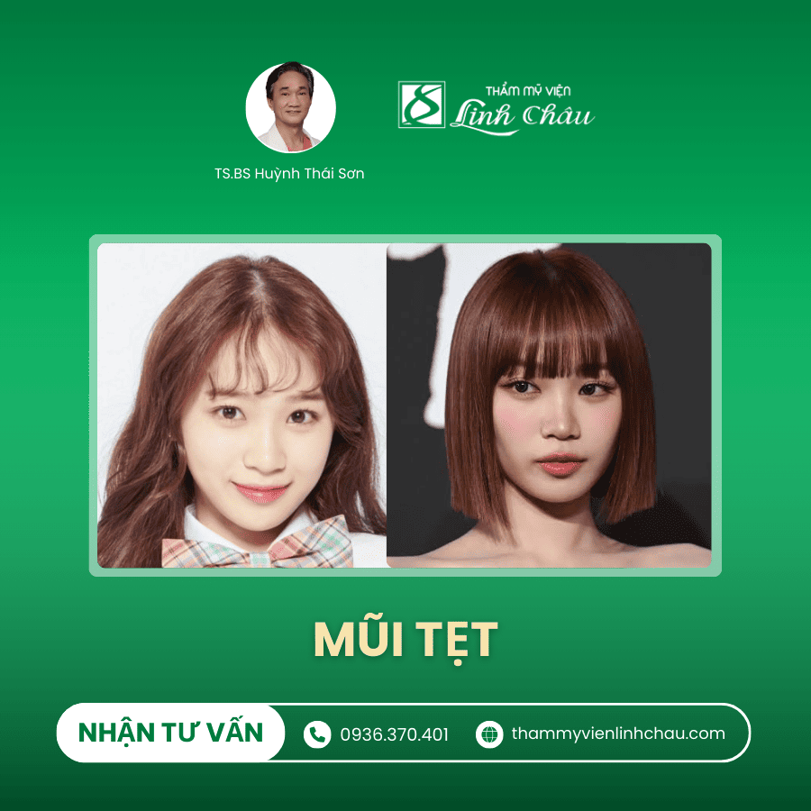 Dáng Mũi Tẹt - TMV Linh Châu