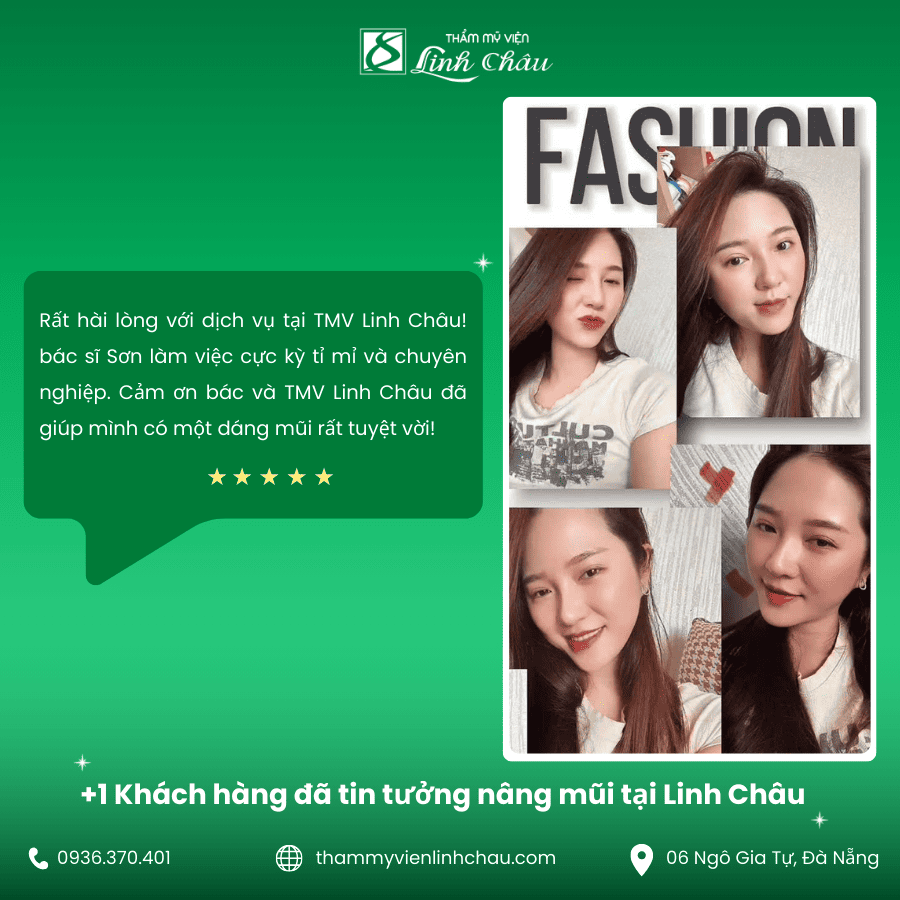 Review khách hàng nâng mũi tại TMV Linh Châu