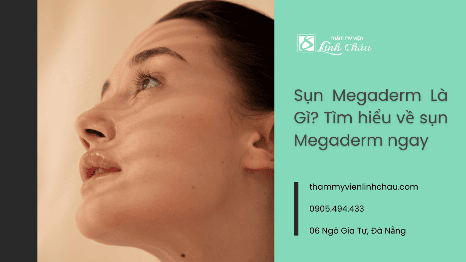 Sụn Megaderm là gì - Tìm hiểu ngay cùng TMV Linh Châu