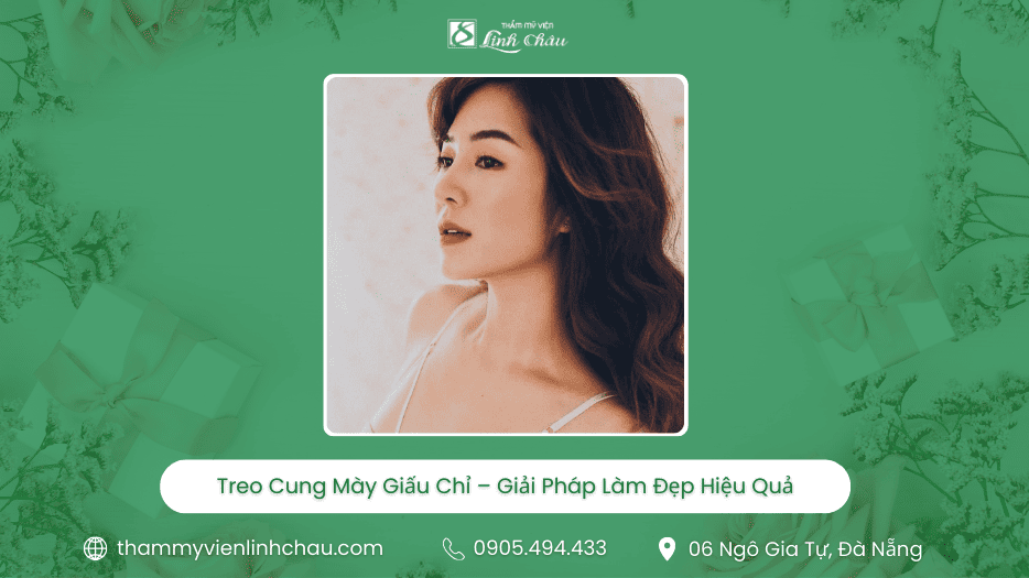 Treo cung mày giấu chỉ - TMV Linh Châu