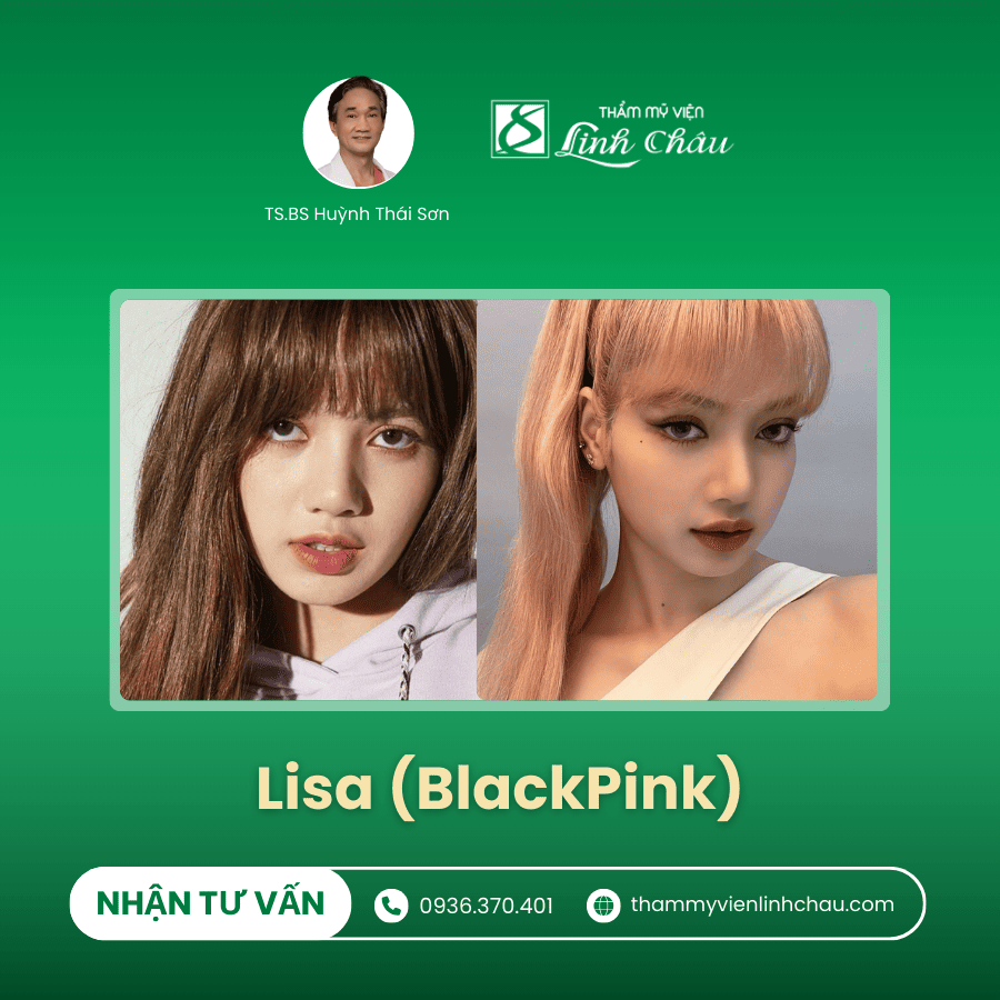 Nâng mũi với Idol Lisa (Blackpink)