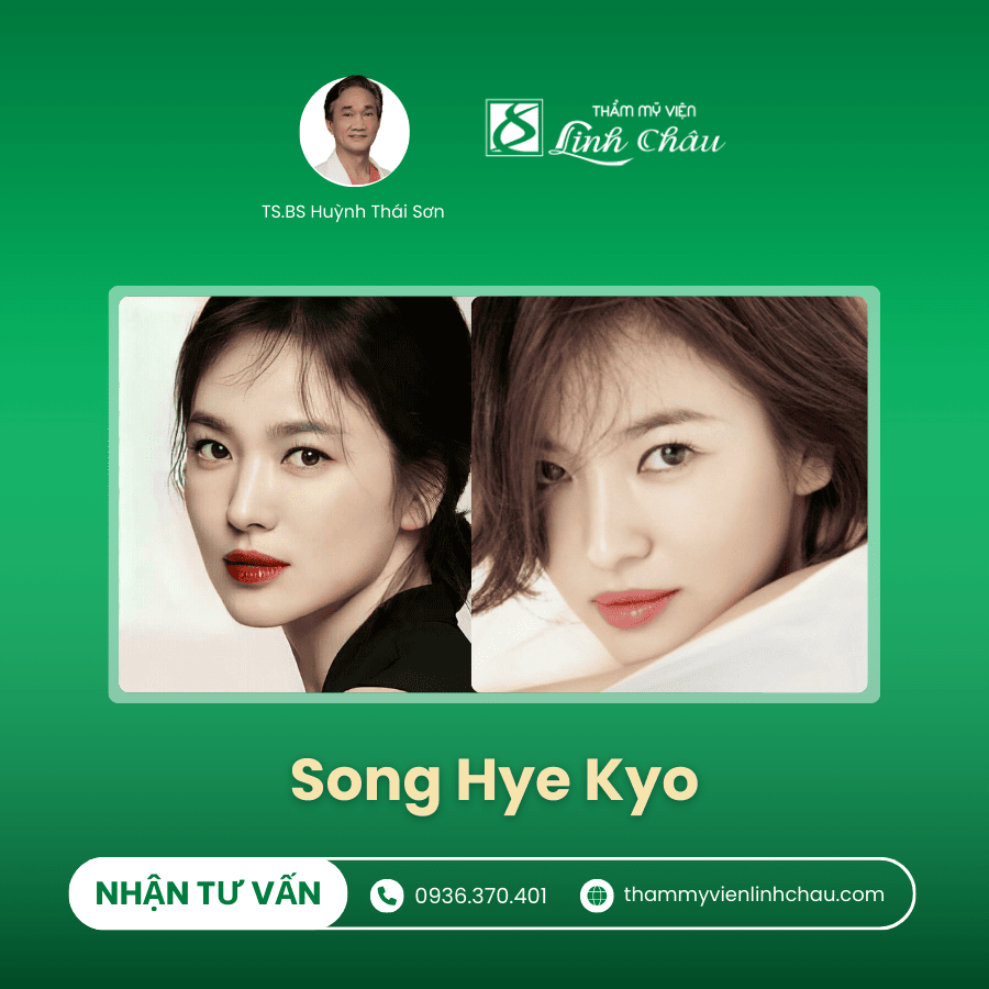 Nâng mũi với Idol Song Hye Kyo