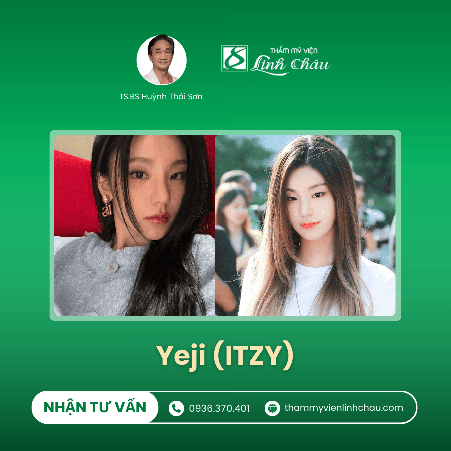 Nâng mũi với Idol Yeji (ITZY)