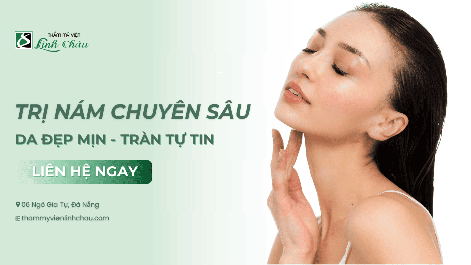 Trị Nám Đà Nẵng | TMV Linh Châu