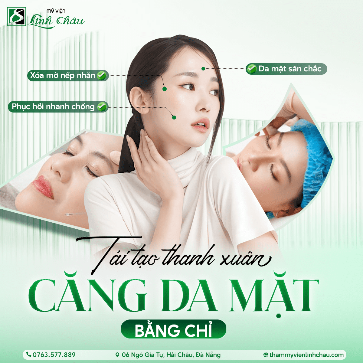 Căng da mặt bằng chỉ collagen